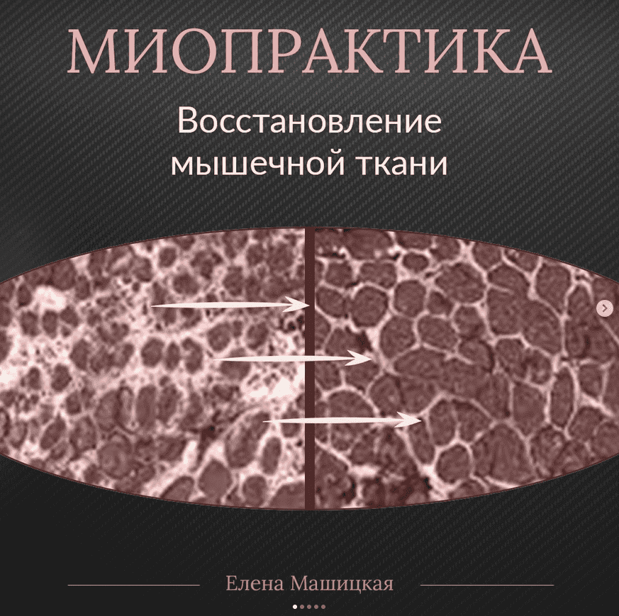 Скачать - Елена Машицкая. Миопрактика 2.0 (2022).png